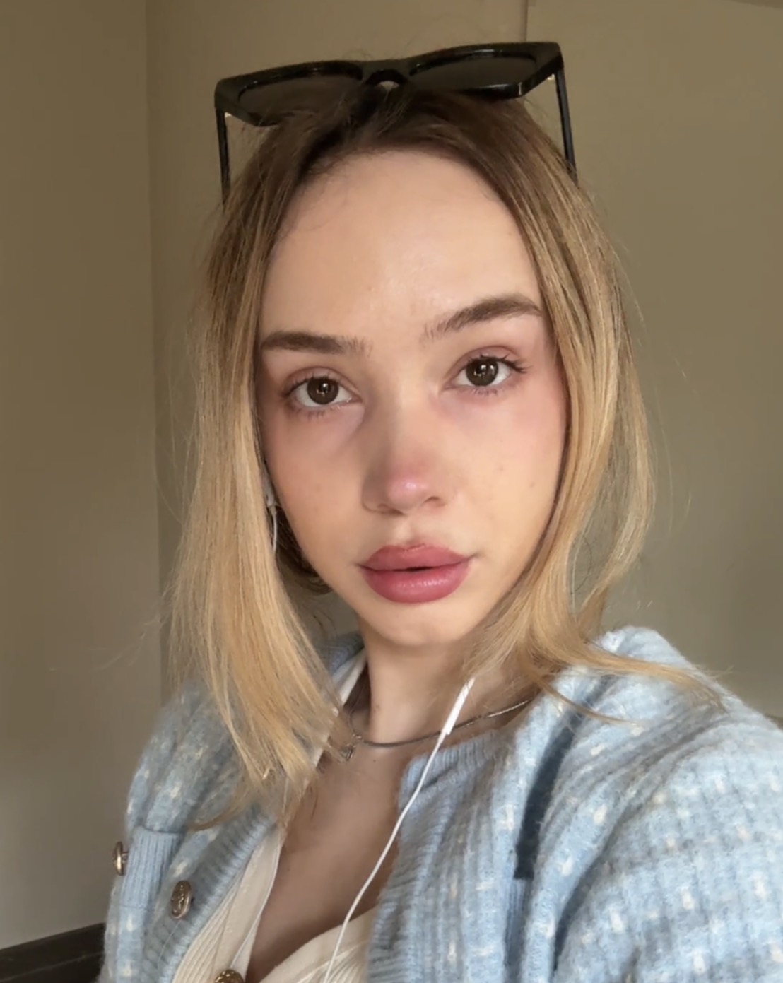 Vlada before the Baseline Beauty Method, example 2